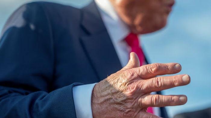 Trump’s hand bruising and leg swelling not serious: White House