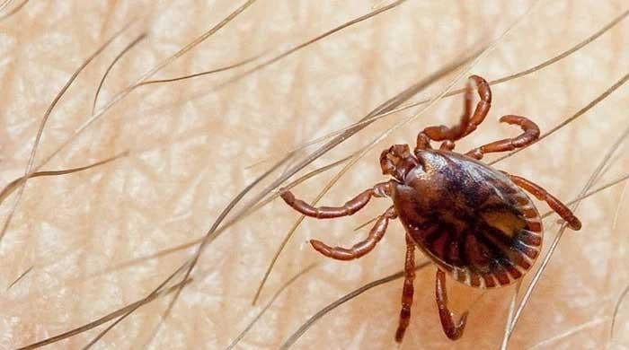 Third Congo fever death reported in Karachi this year