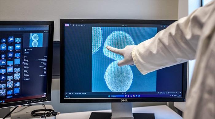 Scientists use human mini-brains to power computers