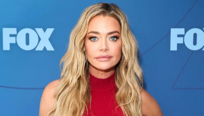 Denise Richards shares facelift transformation details