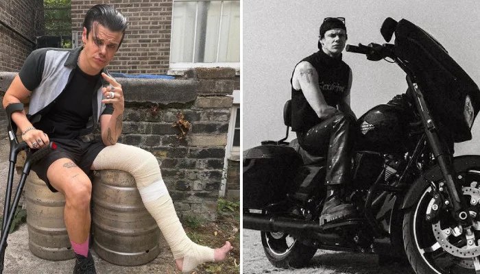 Yungblud injured his leg after returning from his mental health hiatus