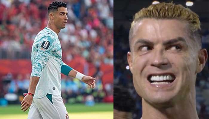 Cristiano Ronaldo’s forehead sparks Botox debate