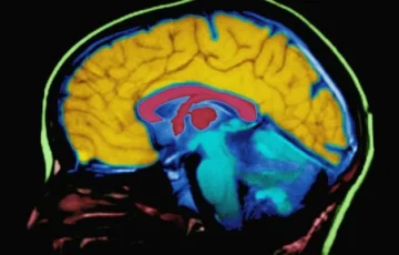 Was the human brain once two separate organs? Scientists find new clues