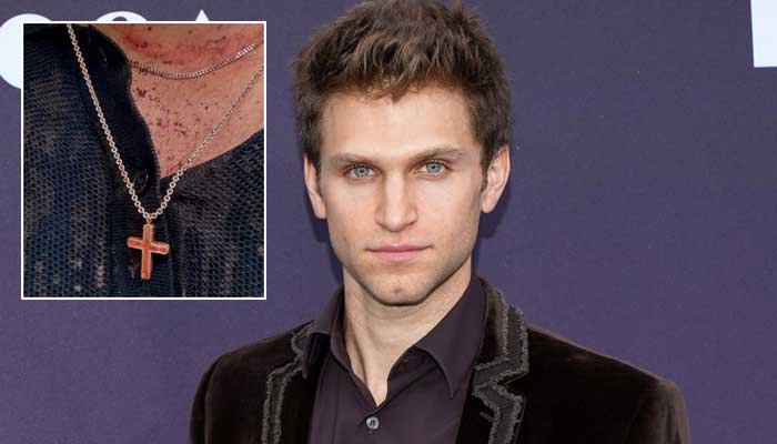 Keegan Allen shares ‘painful’ update after being violently attacked in armed robbery