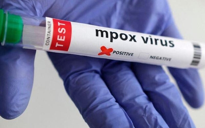 Hospital sealed after mpox detected in newborn