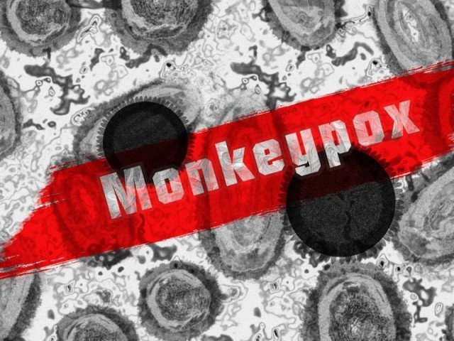 11 deaths, 93 mpox cases reported in Sindh